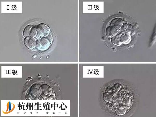 第3天胚胎可以分为四个等级