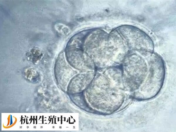 胚胎最多移植3个