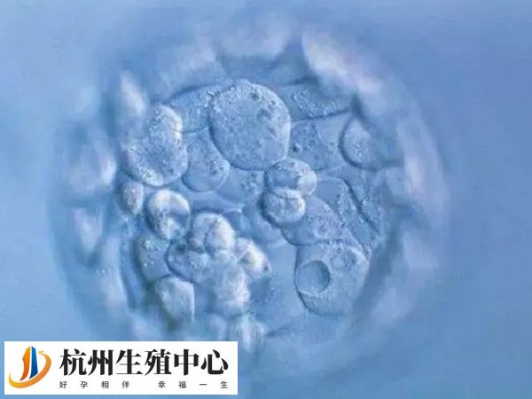 胚胎碎片多与精卵质量有关