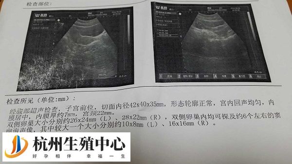 子宫内膜厚度8-14毫米较好