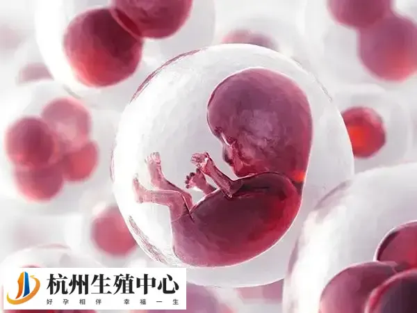 胚胎移植后屁股疼建议适当休息