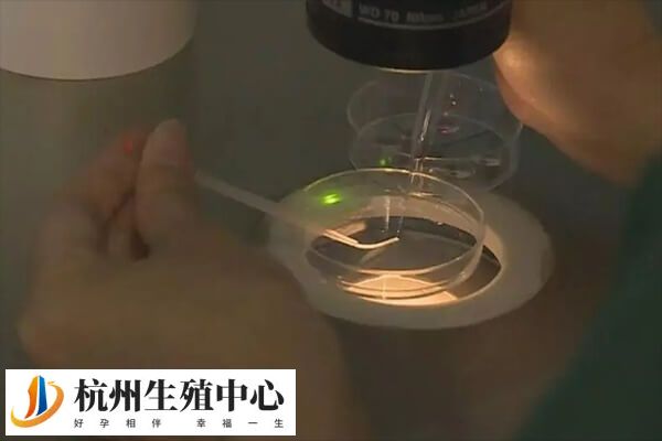 卵泡检查前要注意避免乱用药