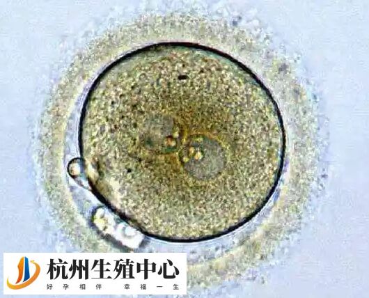 胚胎存在染色体异常会影响胚胎发育潜力