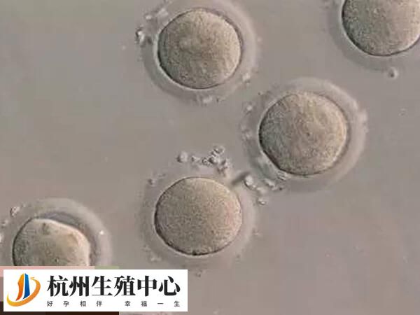 鲜胚移植和冻胚移植<a href=https://www.nzzt.cn/topic/92.html target=_blank class=infotextkey>成功率</a>都差不多