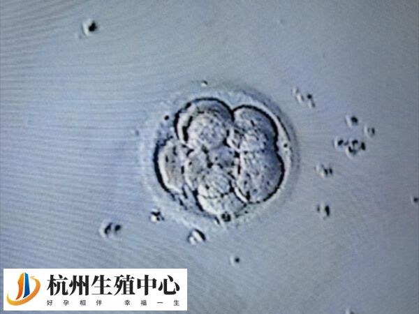 女性每个月只会排出一个成熟的卵子