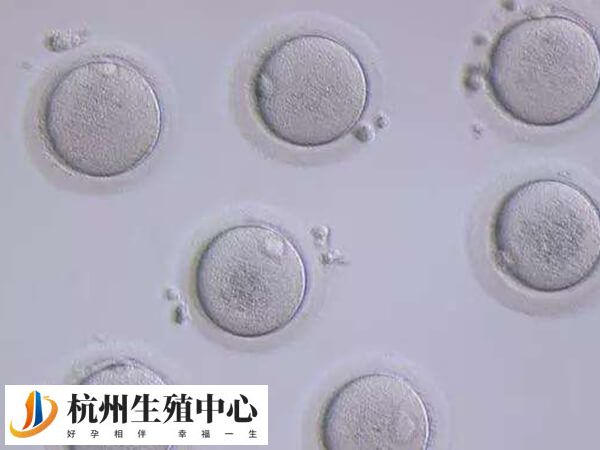 杭州公立医院申请供卵需要等待较长时间
